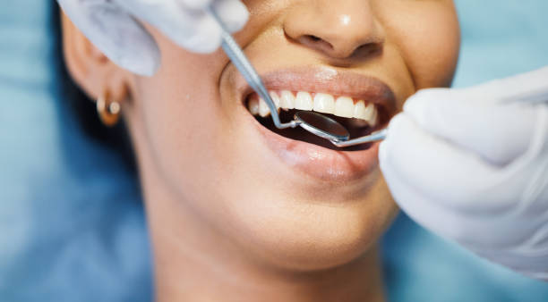 Best Emergency Tooth Extraction in Stony Prairie, OH