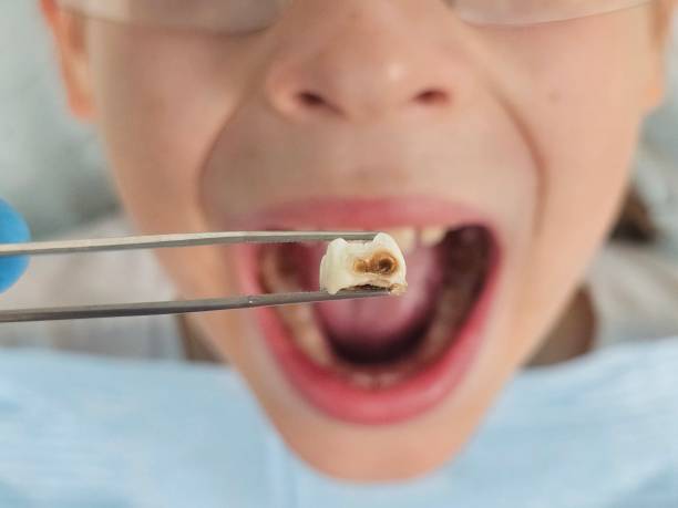 Best After-Hours Dental Trauma Care in Stony Prairie, OH