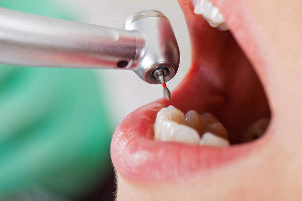 Best Cosmetic Emergency Dentistry in Stony Prairie, OH